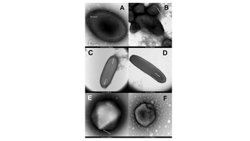 8-virus-‘zombie’-yang-diangkat-dari-lapisan-permafrost